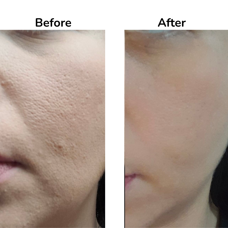 Hypochlorous Acid Rice Peel Shot Duo (Smooth, Clear Skin 12.2 fl oz)