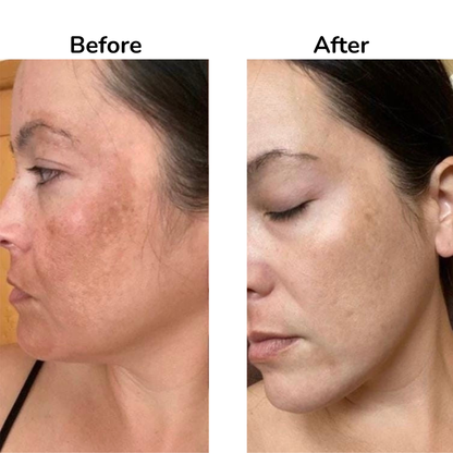 Hypochlorous Acid Rice Peel Shot Duo (Smooth, Clear Skin 12.2 fl oz)